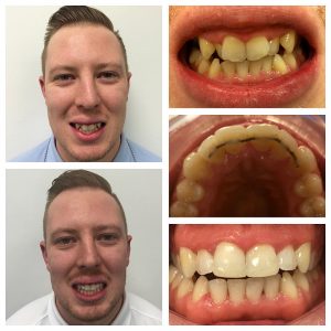 orthodontics-case-02
